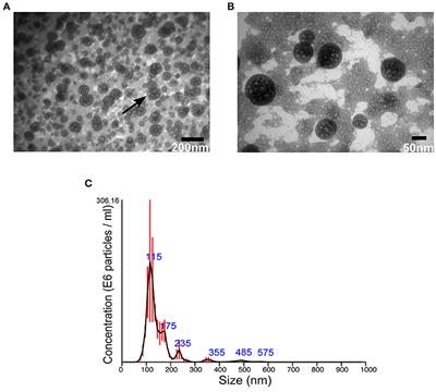 Transcriptome Profiling of Staphylococcus aureus Associated Extracellular Vesicles Reveals Presence of Small RNA-Cargo